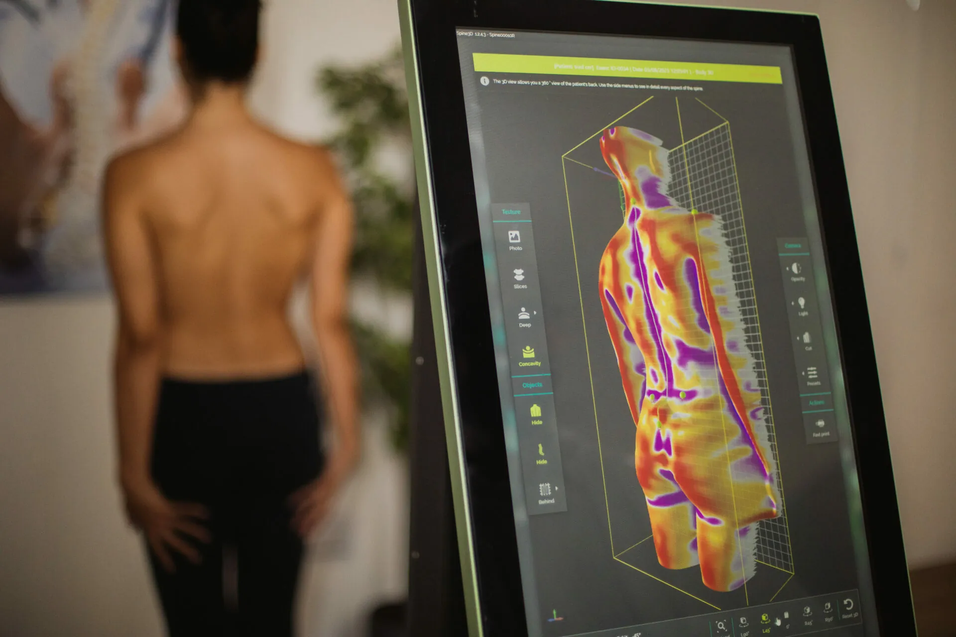 Digital 3D Postural Analysis